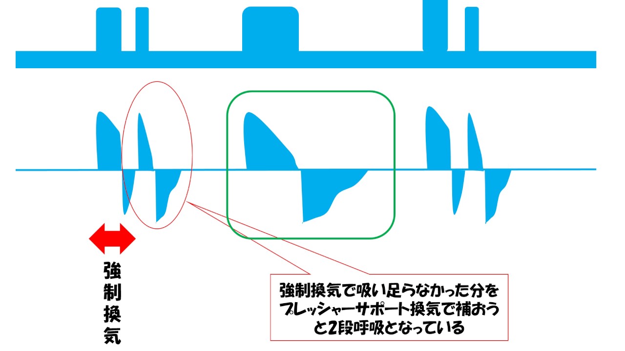 グラフィックカードの設定による高度な色調整