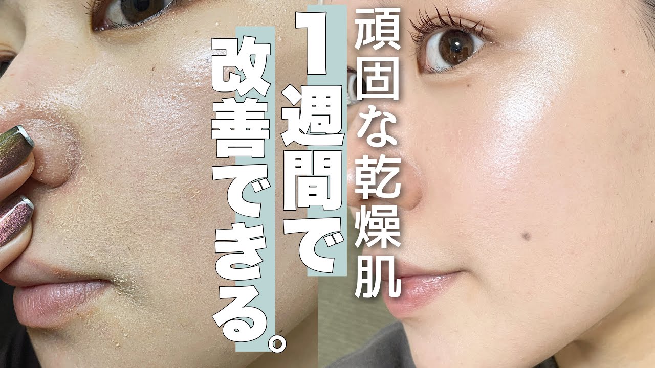 目の乾燥対策