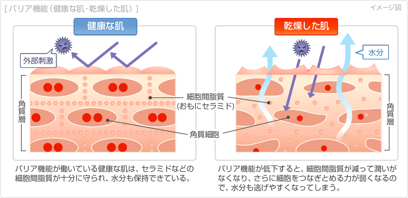 肌荒れ原因：水分不足