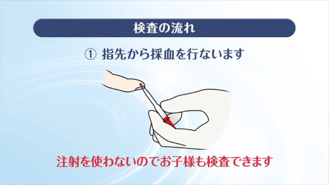 アレルゲン特定のための検査